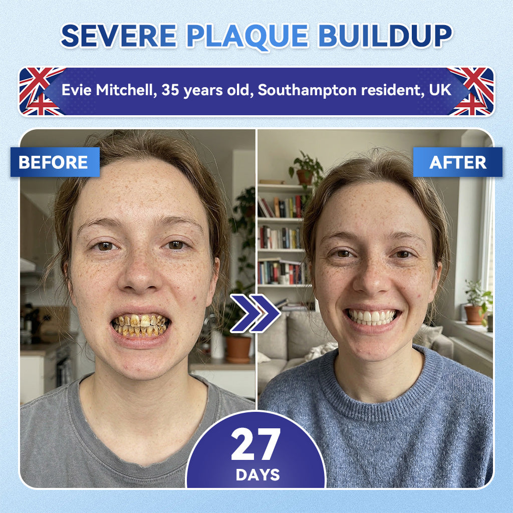 Glimmerly® 🦷 Tideglusib Fast‑Dissolving Tooth & Gum Repair Oral Strips 💥🎉 (Supports tooth repair and helps relieve gum discomfort and other common oral concerns)