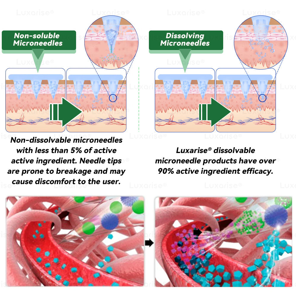 ✅👩‍🔬Once Daily, Visible Changes in 7 Days丨𝑳𝒖𝒙𝒂𝒓𝒊𝒔𝒆® 𝑴𝒐𝒓𝒊𝒏𝒈𝒂 & 𝑩𝒆𝒓𝒃𝒆𝒓𝒊𝒏𝒆 10-𝑰𝑵-1 𝑨𝒅𝒗𝒂𝒏𝒄𝒆𝒅 𝑵𝒂𝒏𝒐 𝑴𝒊𝒄𝒓𝒐𝒏𝒆𝒆𝒅𝒍𝒆 𝑷𝒂𝒕𝒄𝒉 𝐎𝐛𝐞𝐬𝐢𝐭𝐲, 𝐃𝐢𝐚𝐛𝐞𝐭𝐞𝐬, 𝐒𝐥𝐞𝐞𝐩 𝐀𝐩𝐧𝐞𝐚, 𝐀𝐧𝐝 𝐉𝐨𝐢𝐧𝐭 𝐈𝐬𝐬𝐮𝐞𝐬