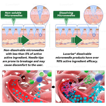Once Daily, Visible Changes in 7 Days 👨‍🔬 𝑳𝒖𝒙𝒂𝒓𝒊𝒔𝒆® 𝑴𝒐𝒓𝒊𝒏𝒈𝒂 & 𝑩𝒆𝒓𝒃𝒆𝒓𝒊𝒏𝒆 10-𝑰𝑵-1 𝑨𝒅𝒗𝒂𝒏𝒄𝒆𝒅 𝑵𝒂𝒏𝒐 𝑴𝒊𝒄𝒓𝒐𝒏𝒆𝒆𝒅𝒍𝒆 𝑷𝒂𝒕𝒄𝒉 ✅ 𝐎𝐛𝐞𝐬𝐢𝐭𝐲, 𝐃𝐢𝐚𝐛𝐞𝐭𝐞𝐬, 𝐒𝐥𝐞𝐞𝐩 𝐀𝐩𝐧𝐞𝐚, 𝐀𝐧𝐝 𝐉𝐨𝐢𝐧𝐭 𝐈𝐬𝐬𝐮𝐞𝐬🥑