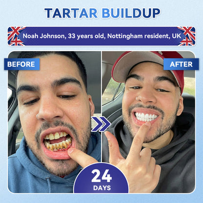 Glimmerly® 🦷 Tideglusib Fast‑Dissolving Tooth & Gum Repair Oral Strips 💥🎉 (Supports tooth repair and helps relieve gum discomfort and other common oral concerns)