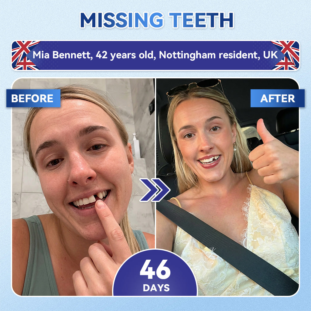 Glimmerly® 🦷 Tideglusib Fast‑Dissolving Tooth & Gum Repair Oral Strips 💥🎉 (Supports tooth repair and helps relieve gum discomfort and other common oral concerns)