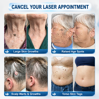 𝐎𝐟𝐟𝐢𝐜𝐢𝐚𝐥 𝐁𝐫𝐚𝐧𝐝 𝐒𝐭𝐨𝐫𝐞 🥇 𝐏i𝐜𝐝o® 7-𝐷𝑎𝑦 𝗧𝐚𝐠 & 𝗦𝗽𝐨𝐭 𝐄𝐫𝒂𝒔𝒆𝒓(Zero Pain, Zero 𝐒𝐜𝐚𝒓𝒔 Rollerball)🏆